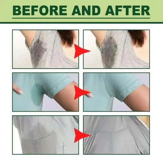 Kūno kvapo šalinimo kremas pažastų, blogo kvapo, prakaitavimo šalinimas pažastų srityje